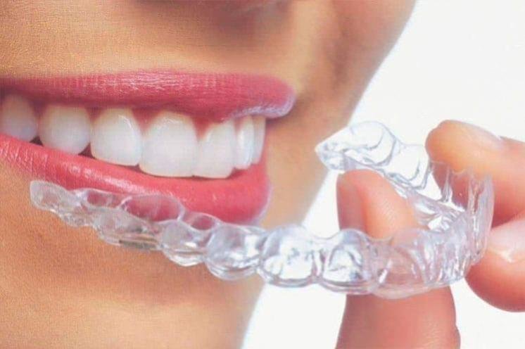 chica colocándose invisalign aparatos dentales invisibles
